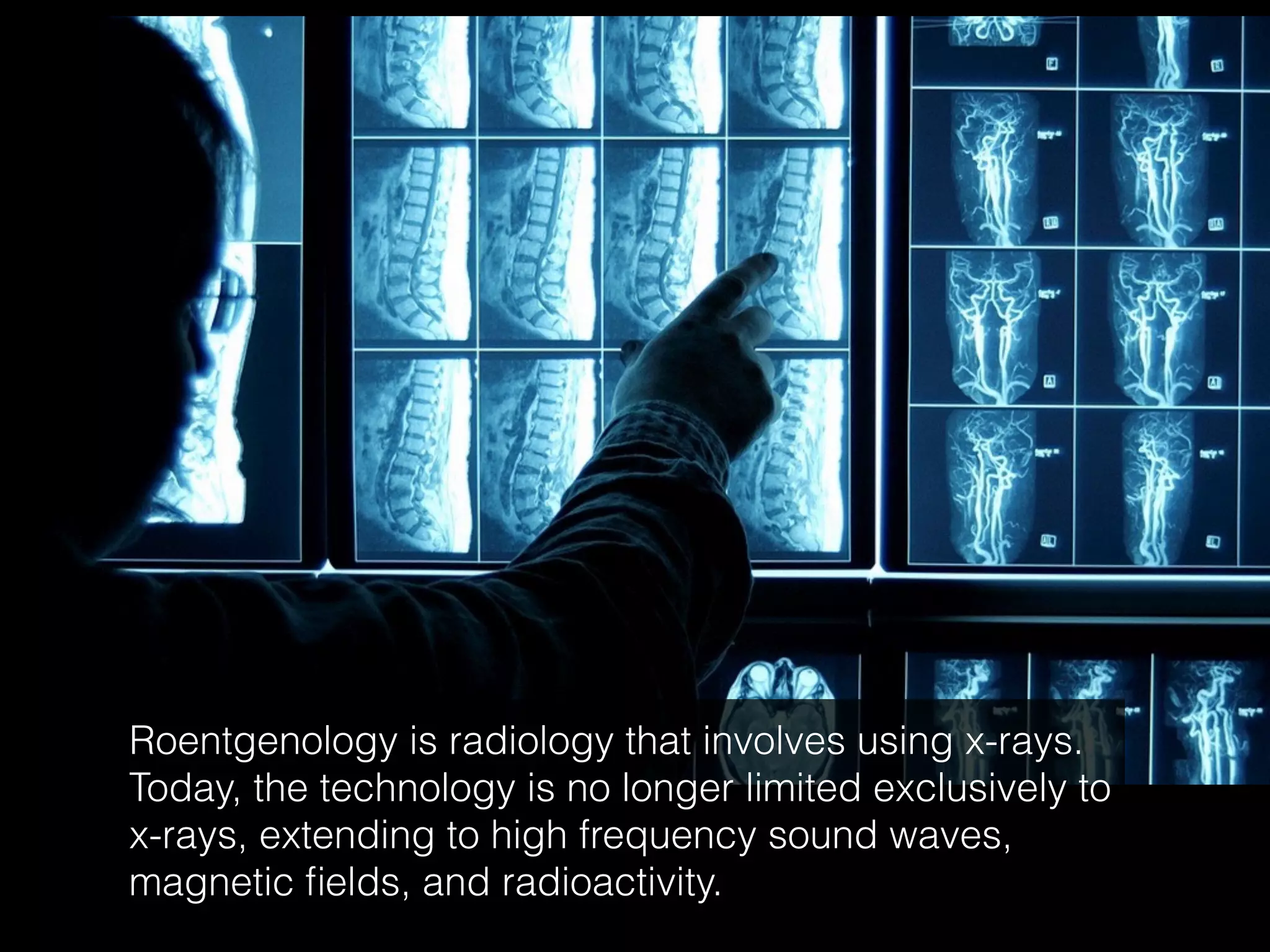 Roentgenology is radiology that involves using x-rays.
Today, the technology is no longer limited exclusively to
x-rays, extending to high frequency sound waves,
magnetic fields, and radioactivity.