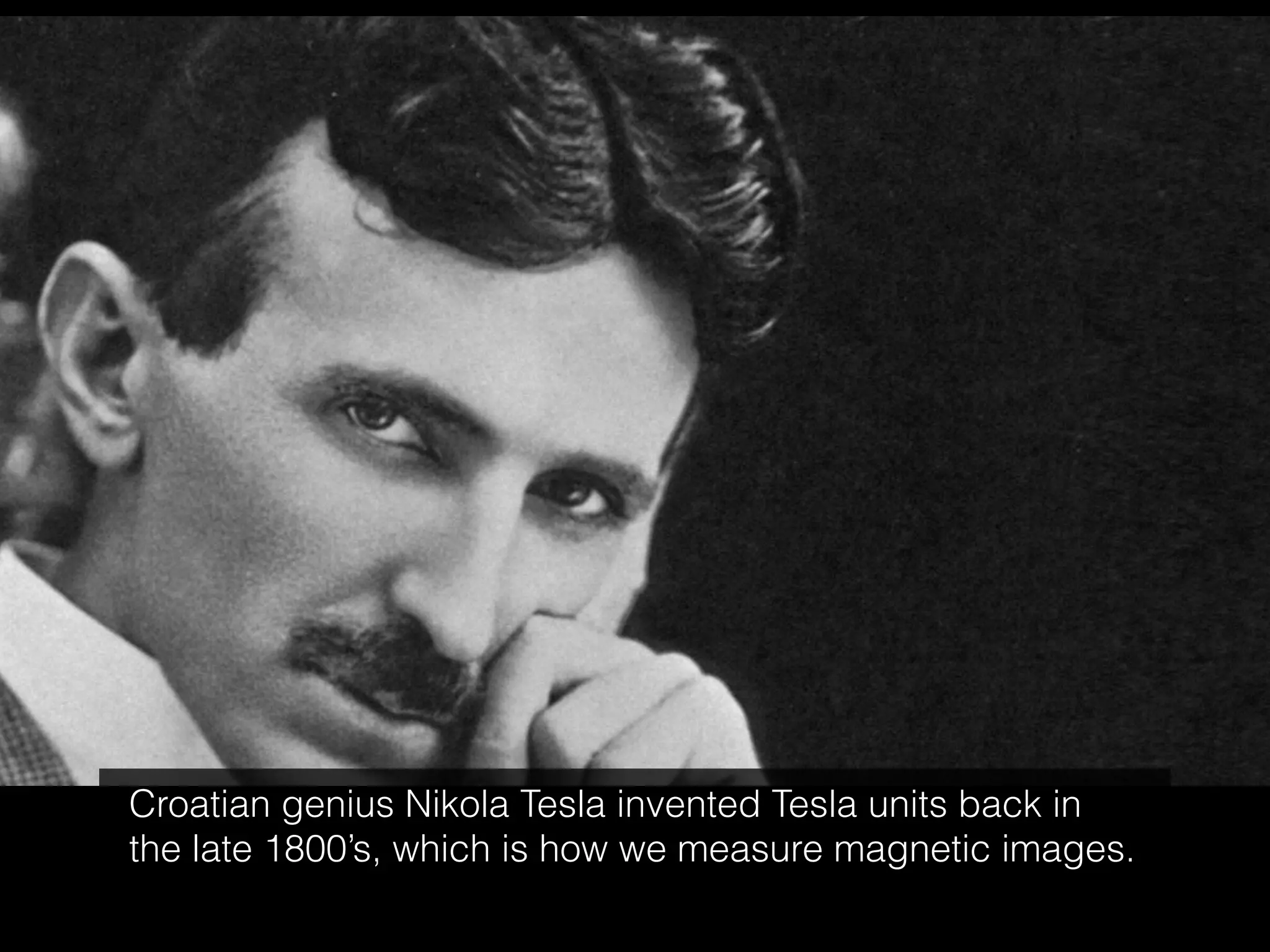 Croatian genius Nikola Tesla invented Tesla units back in
the late 1800’s, which is how we measure magnetic images.