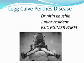 Legg Calve Perthes Disease
             Dr nitin kaushik
             Junior resident
             ESIC PGIMSR PAREL
 