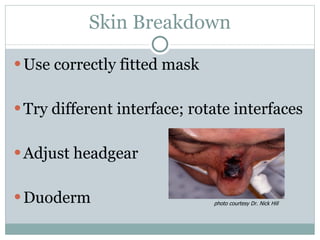 Skin Breakdown Use correctly fitted mask Try different interface; rotate interfaces Adjust headgear Duoderm photo courtesy Dr. Nick Hill 