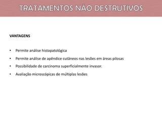 VANTAGENS

•

Permite análise histopatológica

•

Permite análise de apêndice cutâneos nas lesões em áreas pilosas

•

Possibilidade de carcinoma superficialmente invasor.

•

Avaliação microscópicas de múltiplas lesões

 