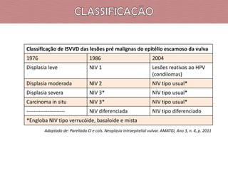 Classificação de ISVVD das lesões pré malignas do epitélio escamoso da vulva
1976

1986

2004

Displasia leve

NIV 1

Lesões reativas ao HPV
(condilomas)

Displasia moderada

NIV 2

NIV tipo usual*

Displasia severa

NIV 3*

NIV tipo usual*

Carcinoma in situ

NIV 3*

NIV tipo usual*

----------------------

NIV diferenciada

NIV tipo diferenciado

*Engloba NIV tipo verrucóide, basaloide e mista
Adaptado de: Parellada CI e cols. Neoplasia intraepitelial vulvar. AMATGI, Ano 3, n. 4, p. 2011

 