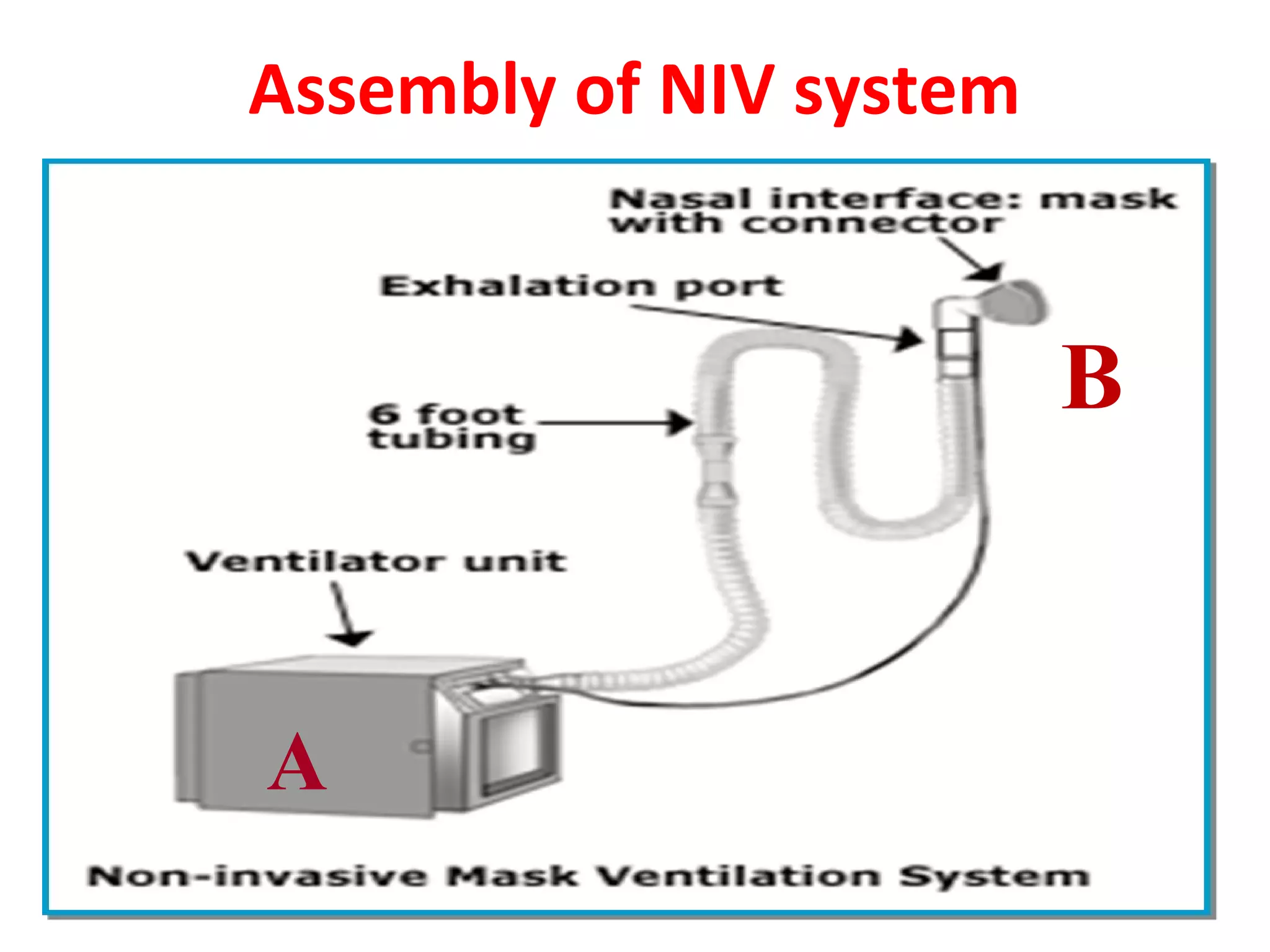 Assembly of NIV system
A
B
 