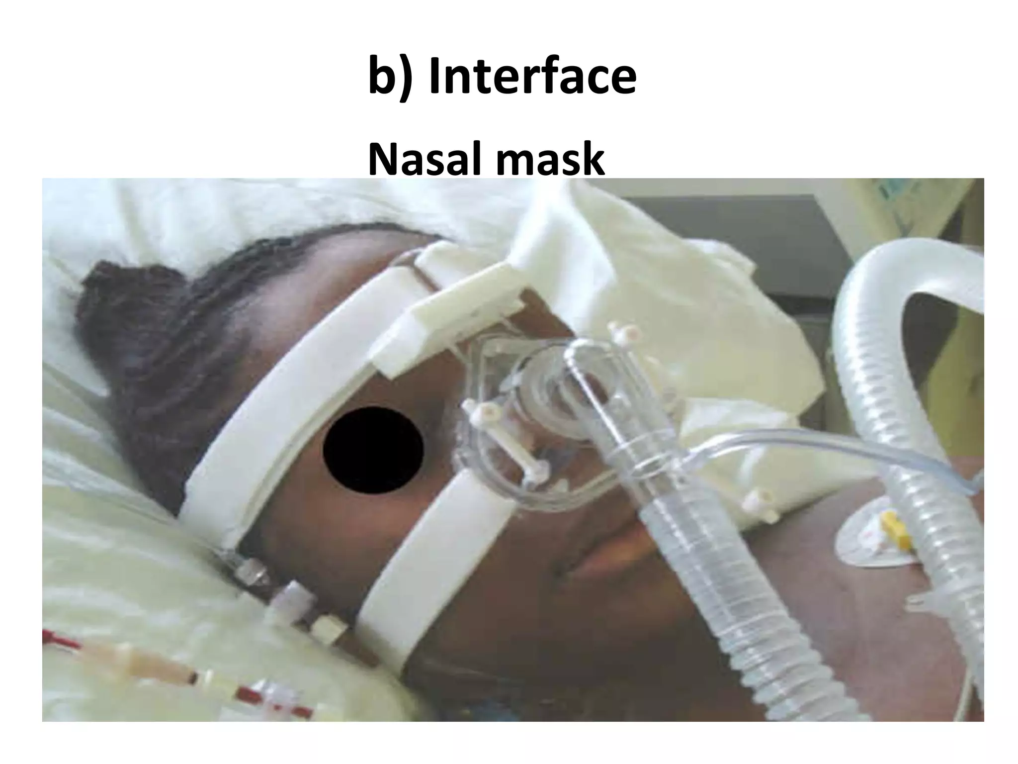 b) Interface
Nasal mask
 