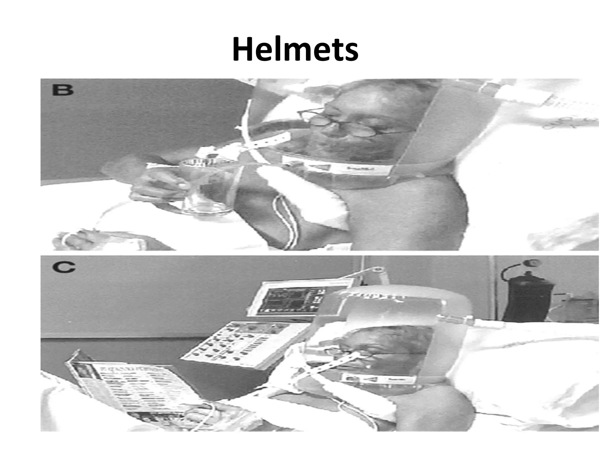Helmets
 