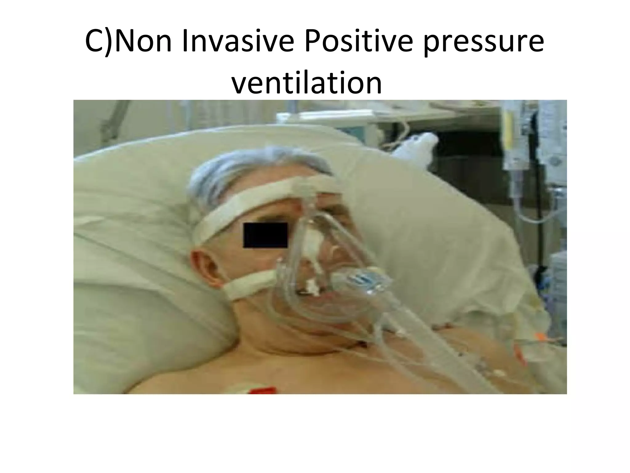 C)Non Invasive Positive pressure
ventilation
 