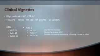 Clinical Vignettes
• 81yo male with IHD, CCF, AF
• T 36.3*C RR 40 HR 120 BP 170/90 O2 sat 80%
• ABG
• pH 7.29
• PaO2 42
• PaCO2 38
• ABG 2
• pH 7.31
• PaO2 37
• PaCO2 36
Low PaO2 in isolation
Worsening despite CPAP
Consider increasing pressure by 1-2mmHg , titrate to effect
 