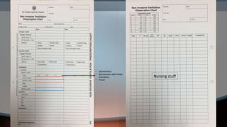 • Spontaneous
• Spontaneous with timed
mandatory
• Timed
Nursing stuff
 