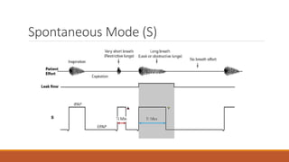 Spontaneous Mode (S)
 