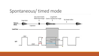 Spontaneous/ timed mode
 