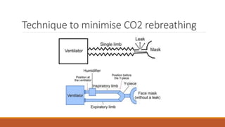 Technique to minimise CO2 rebreathing
 