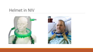 Helmet in NIV
 