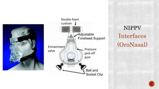 Interfaces
(OroNasal)
 