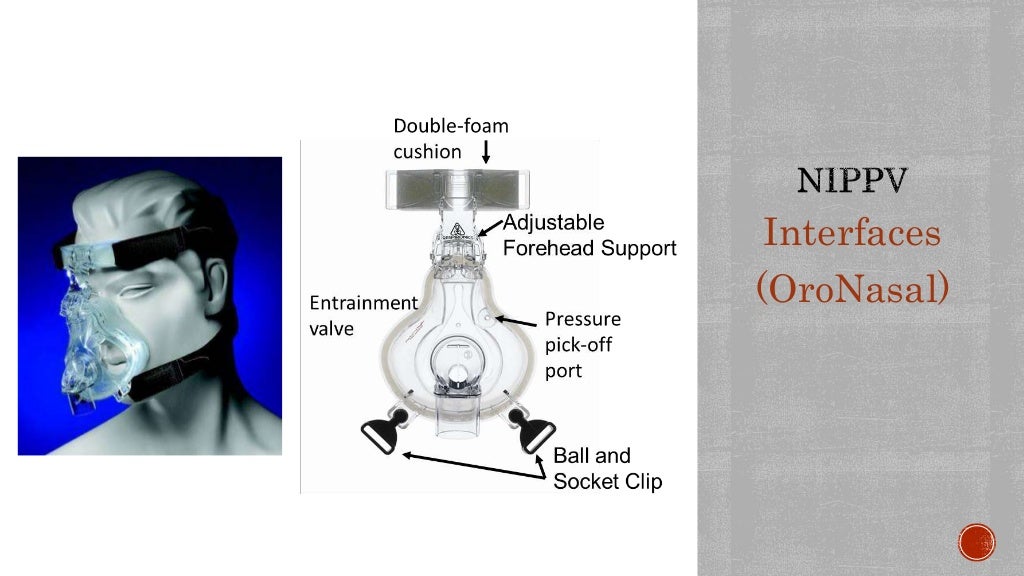 NIV (Non Invasive Mechanical Ventilation)