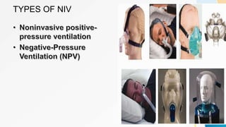 TYPES OF NIV
 