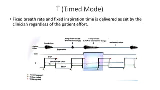 T (Timed Mode)
• Fixed breath rate and fixed inspiration time is delivered as set by the
clinician regardless of the patient effort.
 