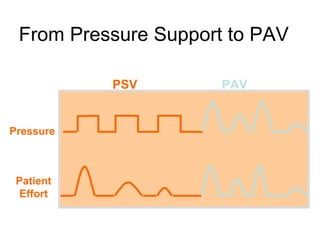 From Pressure Support to PAV Patient Effort Pressure PSV PAV 