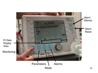 Monitoring Parameters Mode Alarms Alarm  Silence Alarm  Reset 21% options SB IPAP 8 EPAP 3 Rate 12 Pt Data Display Area Scale Fz/ UnFz Mode/Messages ALARMS 