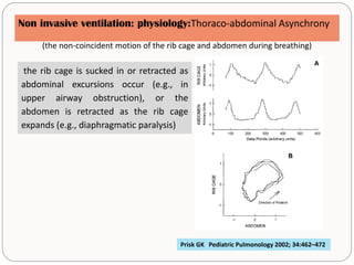 NON INVASIVE VENTILATION IN NEONATE | PPTX
