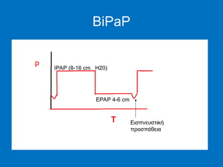 NIV (non invasive vetntilation) for medical students .ppt