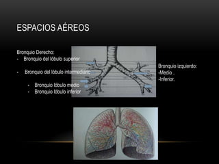 ESPACIOS AÉREOS
Bronquio Derecho:
- Bronquio del lóbulo superior
- Bronquio del lóbulo intermediario
- Bronquio lóbulo medio
- Bronquio lóbulo inferior
Bronquio izquierdo:
-Medio .
-Inferior.
 
