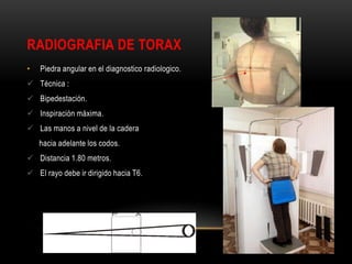 RADIOGRAFIA DE TORAX
• Piedra angular en el diagnostico radiologico.
 Técnica :
 Bipedestación.
 Inspiración máxima.
 Las manos a nivel de la cadera
hacia adelante los codos.
 Distancia 1.80 metros.
 El rayo debe ir dirigido hacia T6.
 