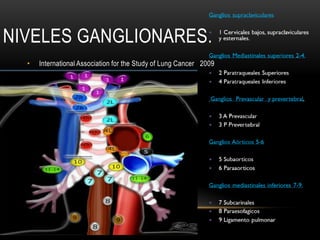 NIVELES GANGLIONARES.
• International Association for the Study of Lung Cancer 2009
 