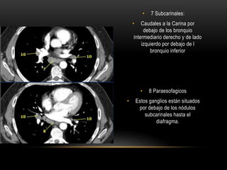 • 7 Subcarinales:
• Caudales a la Carina por
debajo de los bronquio
intermediario derecho y de lado
izquierdo por debajo de l
bronquio inferior
• 8 Paraesofagicos
• Estos ganglios están situados
por debajo de los nódulos
subcarinales hasta el
diafragma.
 