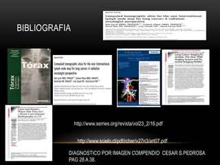 BIBLIOGRAFIA
http://www.semes.org/revista/vol23_2/16.pdf
http://www.scielo.cl/pdf/rcher/v27n3/art07.pdf
DIAGNOSTICO POR IMAGEN COMPENDIO CESAR S.PEDROSA
PAG 28 A 38.
 