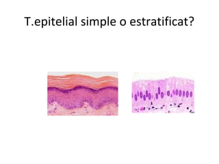 T.epitelial simple o estratificat?

 
