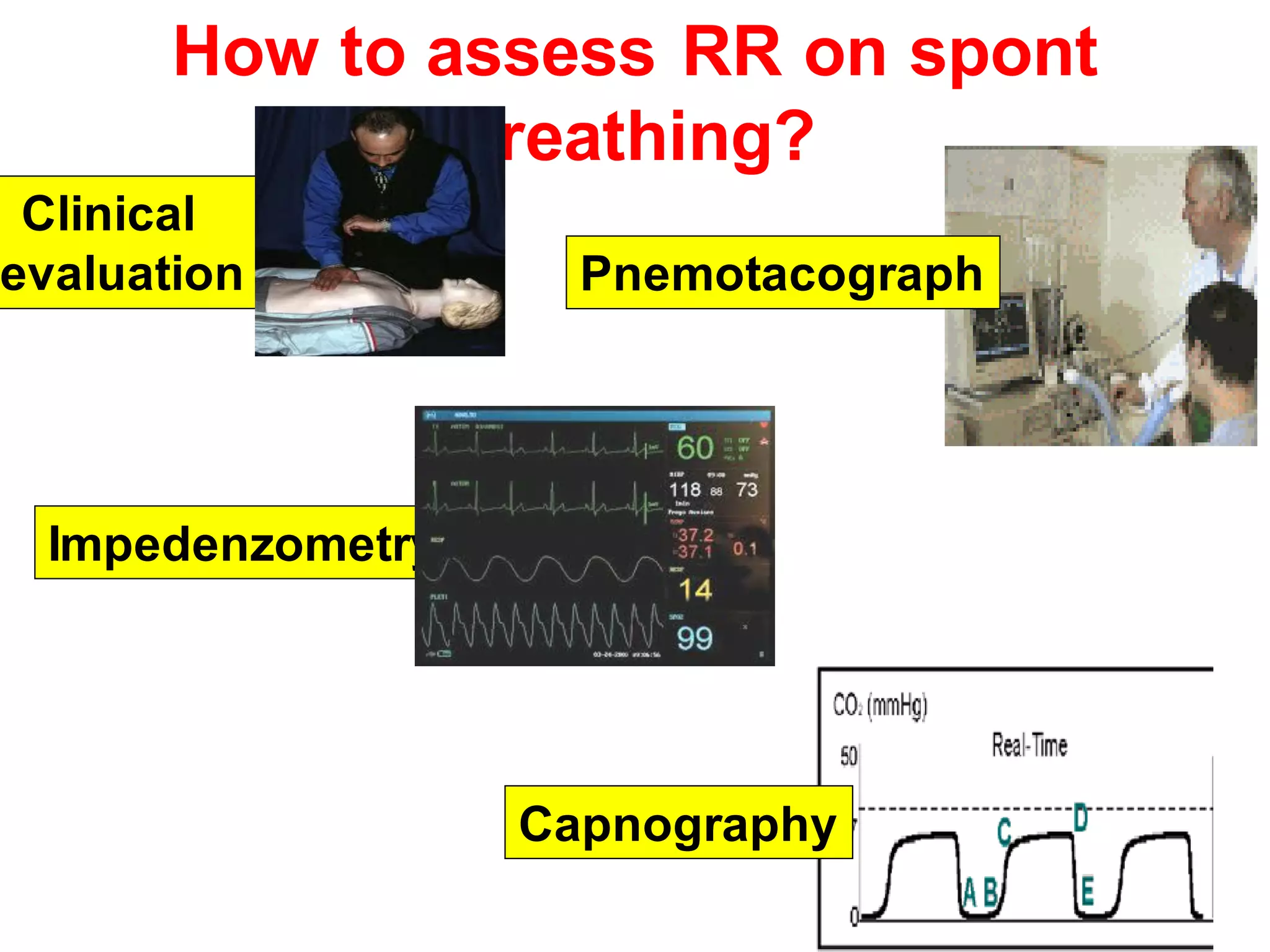 How to assess RR on spont
breathing?
Clinical
evaluation
Impedenzometry
Capnography
Pnemotacograph
 