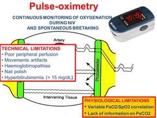 TECHNICAL LIMITATIONS
• Poor peripheral perfusion
• Movements artifacts
• Haemoglobinopathies
• Nail polish
• Hyperbilirubinemia (> 15 mg/dL)
Pulse-oximetry
CONTINUOUSMONITORING OF OXYGENATION
DURINGNIV
AND SPONTANEOUS BRETAHING
PHYSIOLOGICAL LIMITATIONS
• Variable PaO2/SpO2 correlation
• Lack of information on PaCO2
 