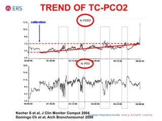 TREND OF TC-PCO2
Kocher S et al, J Clin Monitor Comput 2004
Domingo Ch et al, Arch Bronchoneumol 2006
 