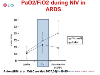 Antonelli M. et al. Crit Care Med 2007;35(1):18-25
PaO2/FiO2 during NIV in
ARDS
 