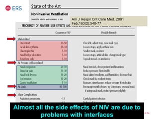 Am J Respir Crit Care Med. 2001
Feb;163(2):540-77
Almost all the side effects of NIV are due to
problems with interfaces
 