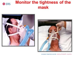 Monitor the tightness of the
mask
 