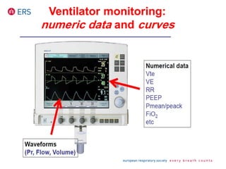 Ventilator monitoring:
numeric data and curves
 
