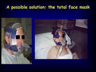 A possible solution: the total face mask
 