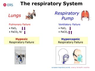 Lungs
Respiratory
Pump
Pulmonary Failure
• PaO2
• PaCO2 N/
Ventilatory Failure
• PaO2
• PaCO2
Hypoxic
Respiratory Failure
Hypercapnic
Respiratory Failure
The respiratory System
 