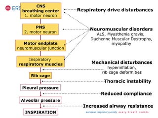 CNS
breathing center
1. motor neuron
PNS
2. motor neuron
Motor endplate
neuromuscular junction
Inspiratory
respiratory muscles
Rib cage
Pleural pressure
Alveolar pressure
INSPIRATION
Respiratory drive disturbances
Neuromuscular disorders
ALS, Myasthenia gravis,
Duchenne Muscular Dystrophy,
myopathy
Mechanical disturbances
hyperinflation,
rib cage deformities
Thoracic instability
Reduced compliance
Increased airway resistance
 