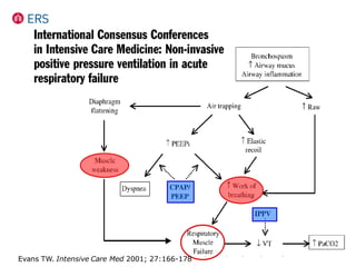 Evans TW. Intensive Care Med 2001; 27:166-178
 