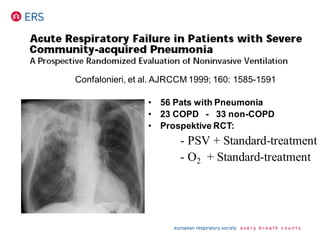 Confalonieri, et al. AJRCCM 1999; 160: 1585-1591
• 56 Pats with Pneumonia
• 23 COPD - 33 non-COPD
• Prospektive RCT:
- PSV + Standard-treatment
- O2 + Standard-treatment
 