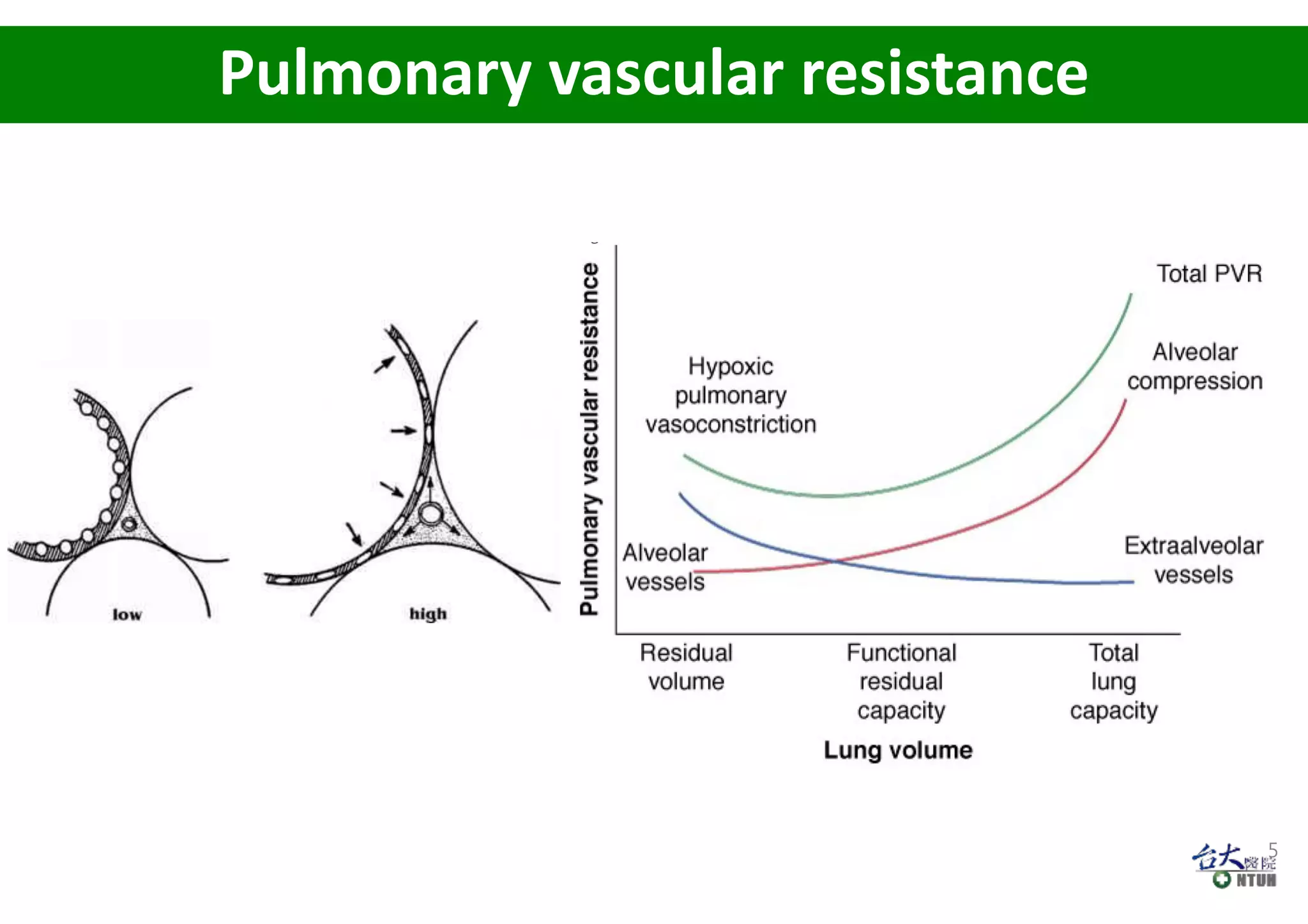 Pulmonary vascular resistance
5
 