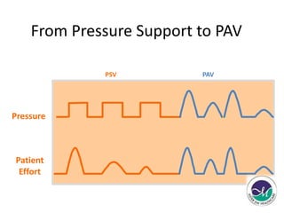 From Pressure Support to PAV 
Pressure 
Patient 
Effort 
PSV PAV 
 