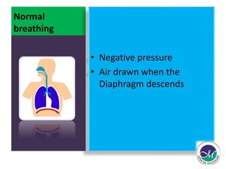 Normal 
breathing 
• Negative pressure 
• Air drawn when the 
Diaphragm descends 
 