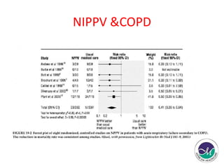 NIPPV &COPD 
 