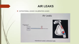 AIR LEAKS
 INTENTIONAL LEAKS/ CALIBRATED LEAKS
 