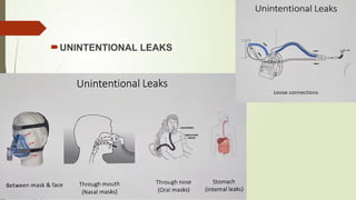 UNINTENTIONAL LEAKS
 