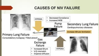 CAUSES OF NIV FAILURE
 