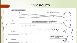 NIV CIRCUITS
 